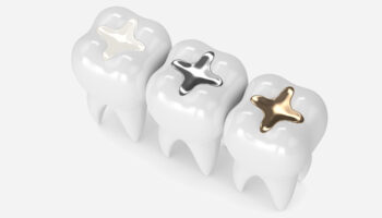 Different Types of Cavity Fillings: A Comprehensive Guide